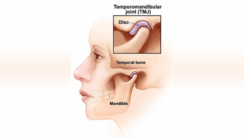 TMJ Treatment