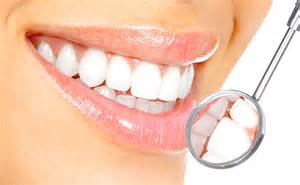 teeth-whitening Different Methods of Bleaching (2)