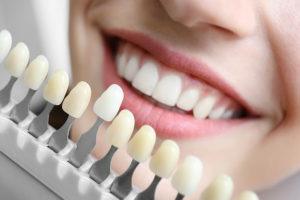 South End Boston Mass Tooth Whitening Services