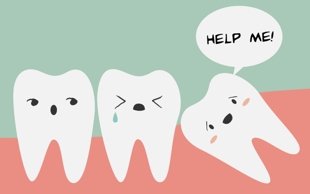 best-wisdom-teeth-services-at-dental-care-south-end-boston