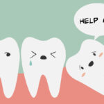 Best Wisdom Teeth Services at Dental Care South End Boston