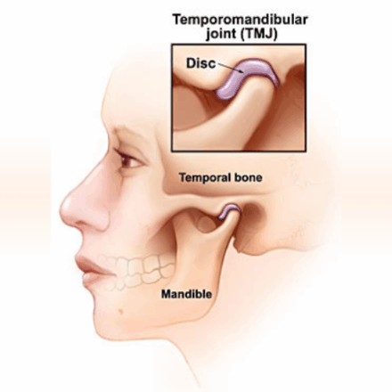 TMJ Treatment