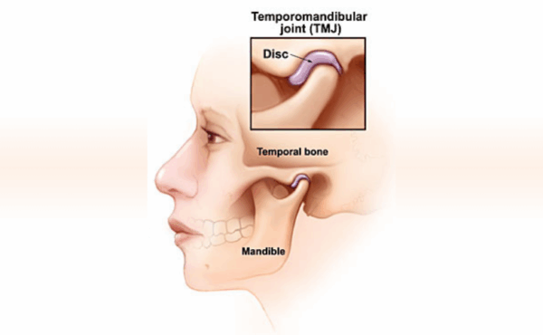 TMJ Treatment
