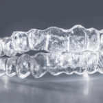Invisalign